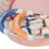 3 D FUSION FIRM SET Garrison Composi-Tight®3D Fusion™ FIRM set