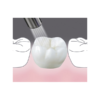 BeautiSealant3 BeautiSealant