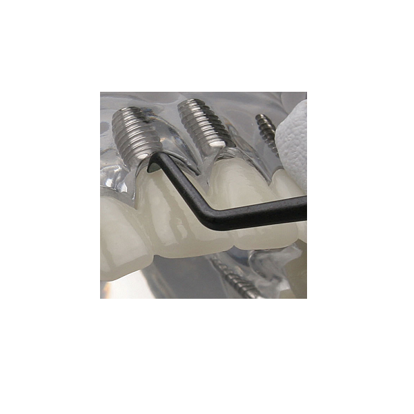 Vestibularni skaler za implantate - 2 kom